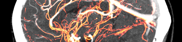 Researchers Leverage Two Photon Microscopy and Mesoscopic Imaging to Capture Real-Time Brain Activity