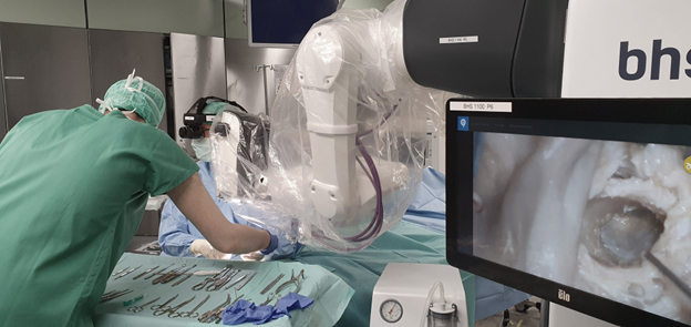 Stäubli helped BHS Technologies develop a revolutionary surgical microscope. Head movements control the robotic camera hands-free, allowing surgeons to constantly view the operating area. (Image courtesy of Stäubli.)