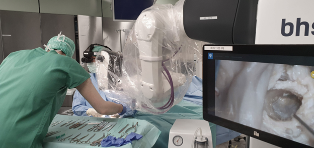 Stäubli helped BHS Technologies manufacture a innovative surgical microscope. Head actions defend watch over the robotic digicam fingers-free, permitting surgeons to continuously ogle the working space. (Picture courtesy of Stäubli.)