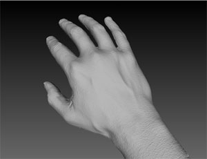 Allied Vision Technologies 3D Arthritis Hand Scanner