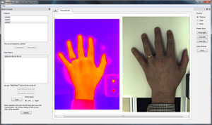 3D Rendition of a patient's hand, with Allied Vision Technologies' arthritis scanning system