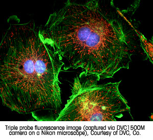 Triple probe fluorescence image (captured via DVC 1500M camera on a Nikon microscope). Courtesy of DVC, Co.