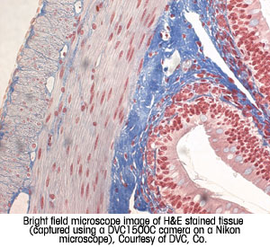 Bright field microscope image of H&E stained tissue, Courtesy of DVC, Co.
