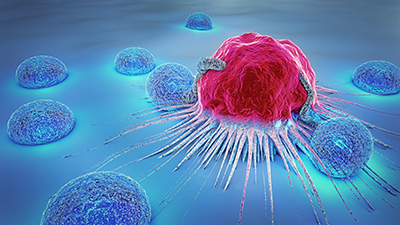 Hyperspectral Imaging Enables Cancer Detection and Image-Guided Surgery