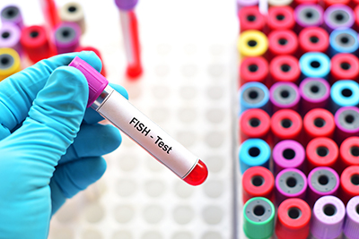 Fluorescence Microscopy: Multicolor Fluorescence in situ Hybridization | Fluorescence Microscopy: Multicolor Fluorescence in situ Hybridization |