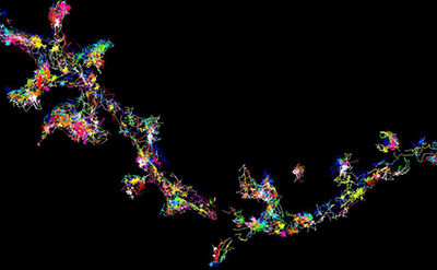Super-resolution Microscopy Uncovers the Causes of Dementia