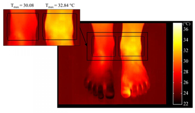 thermal imaging temperature