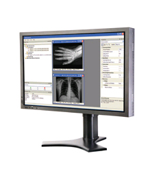 Feature-rich eBUS™ SDK allows vision system designers to quickly and cost-effectively develop standards-compliant video applications Feature-rich eBUS™ SDK allows vision system designers to quickly and cost-effectively develop standards-compliant video applications
