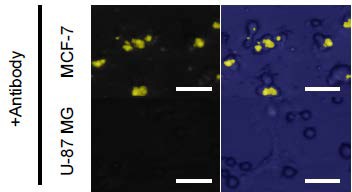 Staining of human breast cancer MCF-7 and human glioblastoma U87MG cells using antibody