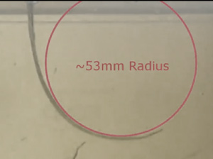 Steerable needle technology can drastically minimize brain damage during surgery