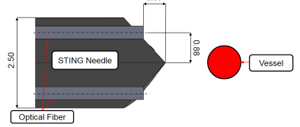 PBN needle, composed of 4 flexible segments propelling it forward and making it bend
