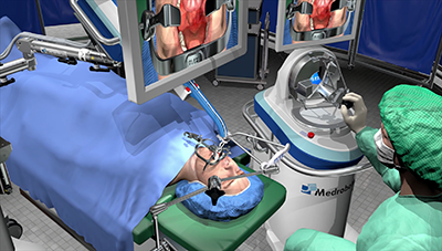 Robotic surgical system uses a joystick-like controller, advanced 3D vision for navigation, and a flexible, steerable scope for minimally invasive transoral and transanal surgery. (Courtesy of Medrobotics Corporation)