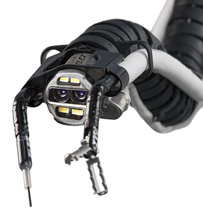 Flexible and steerable robotic scope equipped with a 3D high-definition camera and specially designed flexible surgical instruments helps surgeons visualize and treat hard-to-reach areas of the body. (Courtesy of Medrobotics Corporation)
