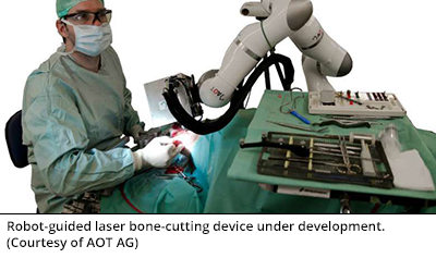 Robot-guided laser bone-cutting device under development. (Courtesy of AOT AG)