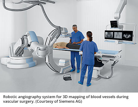 Robotic angiography system for 3D mapping of blood vessels during vascular surgery. (Courtesy of Siemens AG)